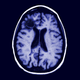 Image for article titled Scientists Determine Tingling Sensation Of ASMR Caused By Mass Brain Cell Die-Off